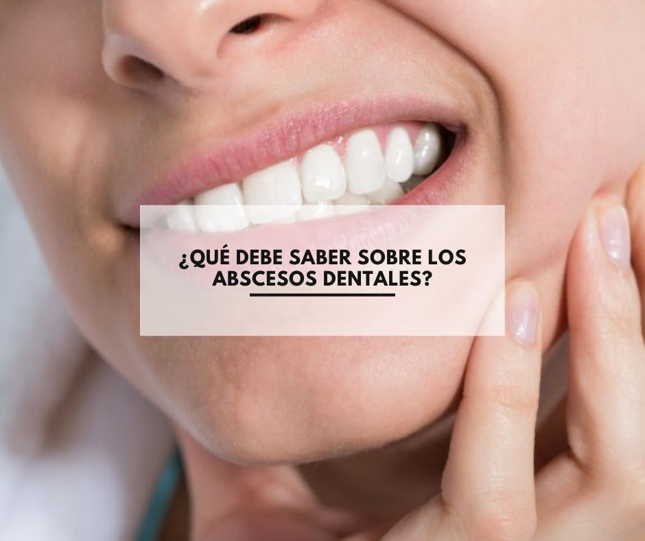¿Qué debe saber sobre los abscesos dentales?